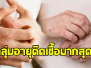 ศูนย์โรคเอดส์ เผยกลุ่มอายุติดเชื้อ เอชไอวี-ซิฟิลิส มากสุดในไทย