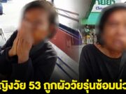 หญิงวัย 53 ถูกผัววัยรุ่นซ้อมน่วม เหตุเมาแล้วหึงหวง