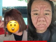 ทำใจยาก! สาวท้องไม่แพ้ แต่หน้าเปลี่ยน 100% สิ้นความมั่นใจ ฝากข้อความถึง “สามี” ทุกคน