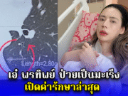 เอ๋ พรทิพย์ ป่วยเป็นมะเร็ง เปิดค่ารักษาล่าสุด