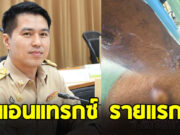 ระวังให้ดี จ.สระแก้ว พบผู้ป่วย แอนแทรกซ์ รายแรก