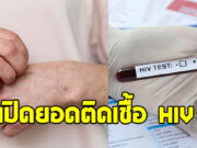 พุ่งปรี๊ด เปิดยอดคนไทยติดเชื้อ HIV เผยสาเหตุอันดับ 1
