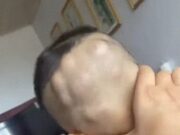 แม่ช็อกมือสั่น ก้อนๆ ปูดเต็มหัวลูกชาย หมอเฉลยคืออะไร ไม่ใช่เนื้องอก แต่ทุกบ้านควรระวัง!