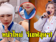 โคตรจึ้ง ตั๊กแตน ชลดา อวดหน้าใหม่ หลังศัลยกรรม