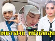 เปิดหน้า ตั๊กแตน ชลดา หลังศัลยกรรมมาได้ 12 วันแล้ว