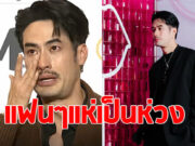 แห่เป็นห่วง บอย ปกรณ์ หลังตาดีเห็นสิ่งผิดปกติบนหน้า