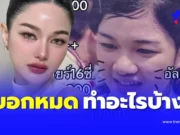ดาราสาว เปิดภาพก่อนศัลยกรรม 16 ปี หมดไป 6 ล้าน คุ้มไหม ทำอะไรบ้าง