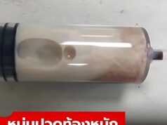 หนุ่มปวดท้องหนัก เจาะเลือดออกมาเป็น “สีขาว” ต้นเหตุคือเมนูโปรด ที่ใครๆ ก็ชอบกิน