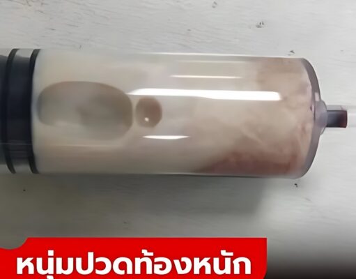 หนุ่มปวดท้องหนัก เจาะเลือดออกมาเป็น “สีขาว” ต้นเหตุคือเมนูโปรด ที่ใครๆ ก็ชอบกิน