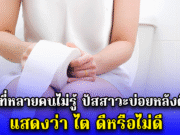 เรื่องที่หลายคนไม่รู้ ปัสสาวะบ่อยหลังดื่มน้ำ แสดงว่า ไต ดีหรือไม่ดี