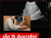 นร.อายุแค่ 15 ไขมันพอกจน “ตับขาวซีด” หมอบอกตรงๆ เพราะ 2 เมนูโปรด ที่ใครก็ชอบกิน!