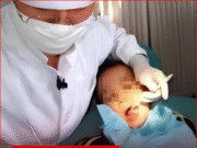 ลูกชาย 7 ขวบ ถูกเพื่อนล้อเพราะมีกลิ่น แม่ตะลึง เห็นสิ่งที่หมอหยิบออกจากปากลูก