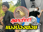 หามด่วน! เบลล่า ราณี เล่าเหตุระทึกแมงป่องต่อยกลางกอง