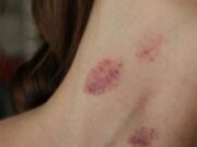 อวสานความฟิน แฟนหนุ่ม “จูบส่วนนี้” สาวอัมพาตเข้าห้องฉุกเฉิน หมอปวดหัว ทำกันแทบทุกคู่!