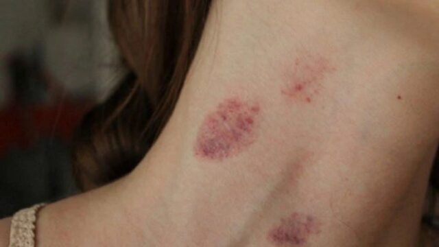 544437423_1102557941981268_152993882858288984_n