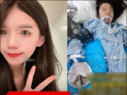 สาววัย 25 สู้มะเร็งตับจนหาย! เปิด 5 อาหารที่ควรเลี่ยงเด็ดขาด!