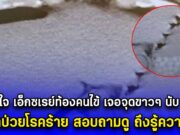 หมอตกใจ เอ็กซเรย์ท้องคนไข้ เจอจุดขาวๆ นับ 20 จุด นึกว่าป่วยโรคร้าย ถามดีๆ ฮาเฉย!