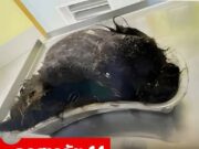 ลูกสาววัย 14 บ่นปวดท้องเกืบครึ่งปี แม่สุดช็อก เมื่อเห็นสิ่งที่หมอผ่าออกจากกระเพาะ